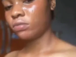 "I Use It Everyday" - Lady Cries Out Over Side Effect Of Contraceptive Pills On Her Skin